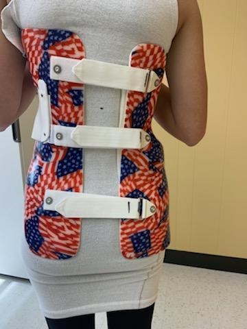 What to Expect When You Start Your Scoliosis Bracing Journey