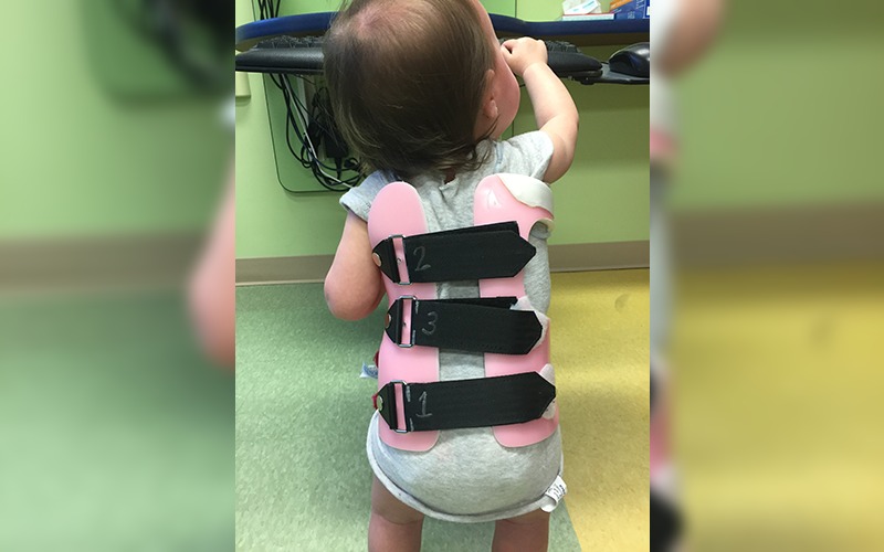 Scoliosis Night Brace