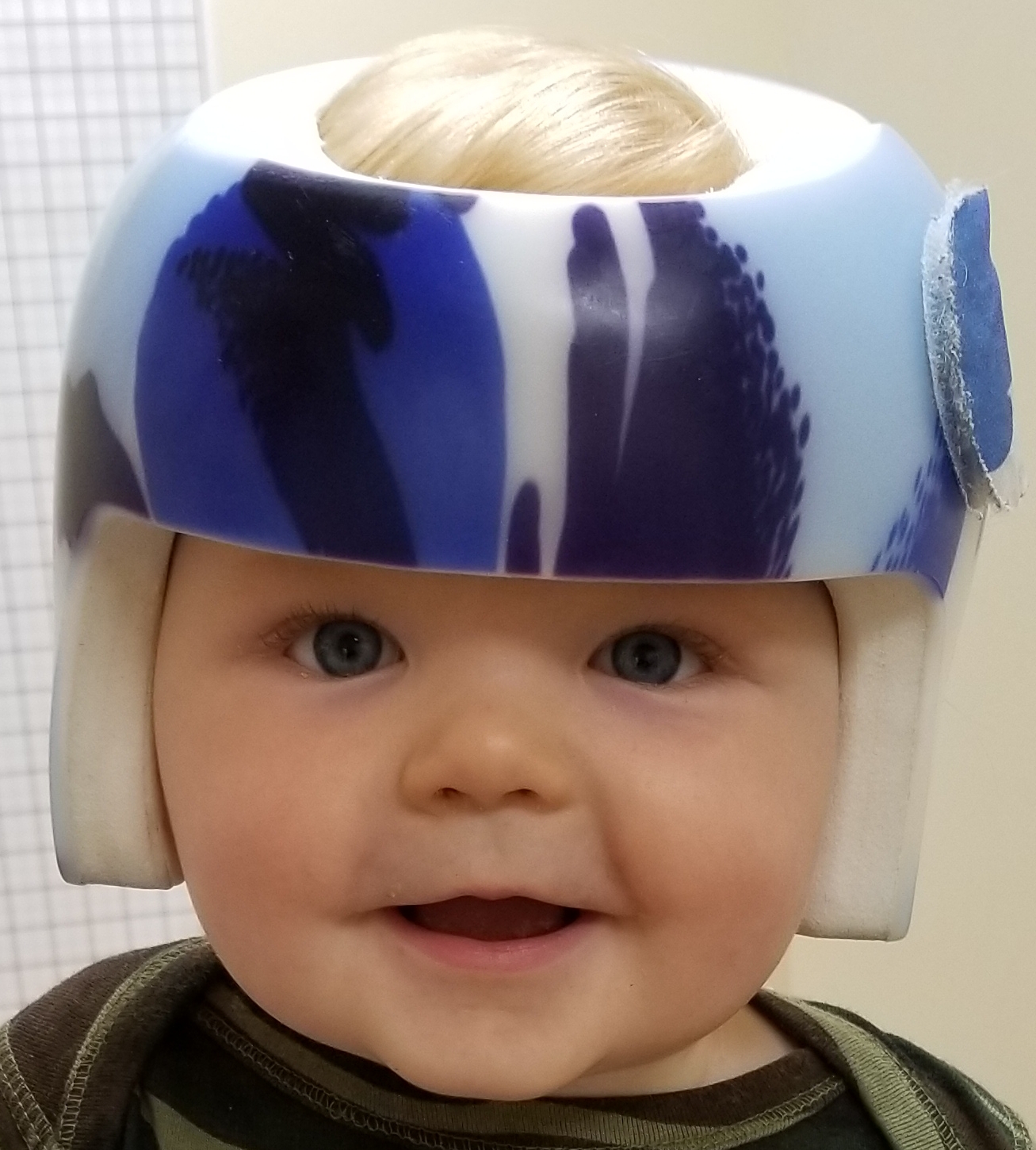 Cranial Remolding Helmets Sleep Surfaces For Plagiocephaly