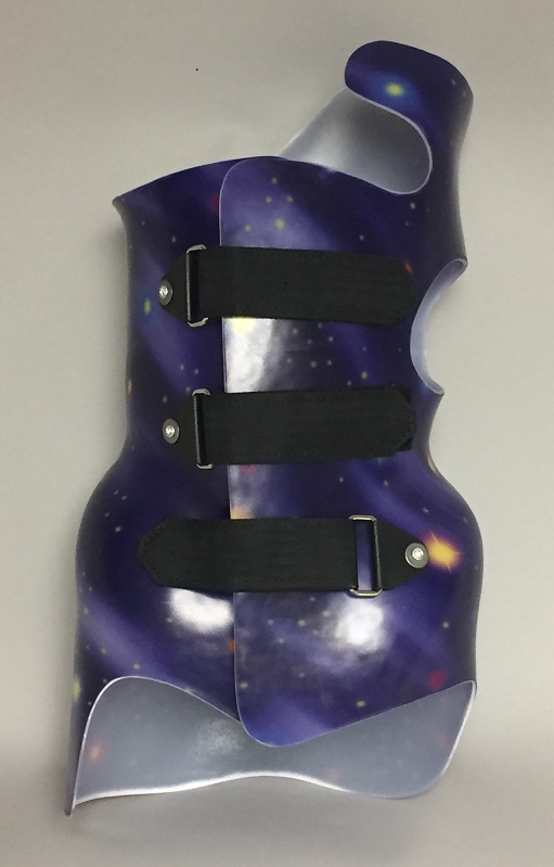 Boston Brace RC  Asymmetrical Custom Scoliosis Brace