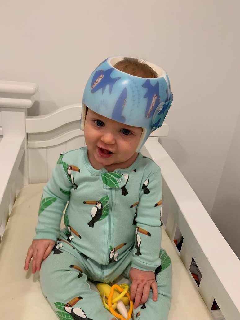 Owen’s Helmeting Story: Mom Notices a Rounder Head After 3 Weeks