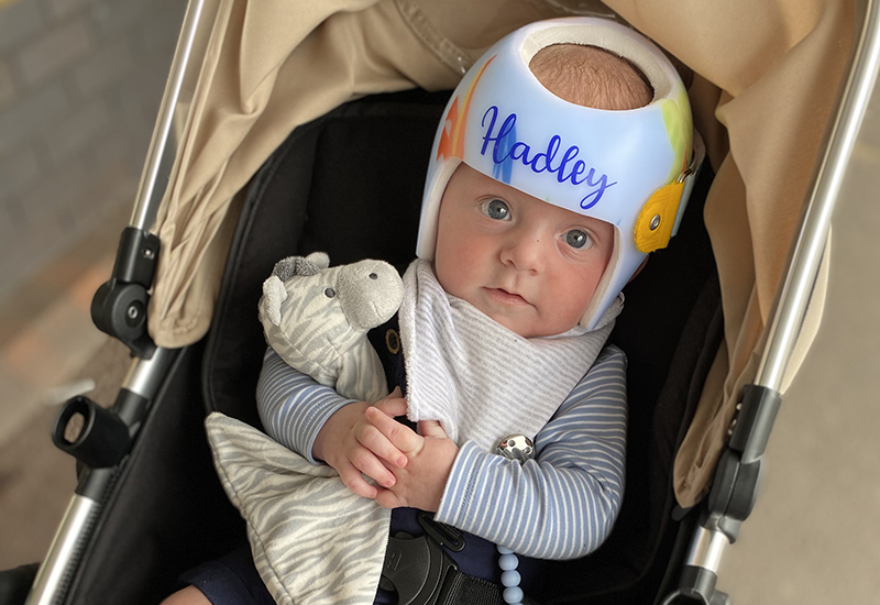 Brachycephaly and Plagiocephaly: Why Hadley Wears a Helmet