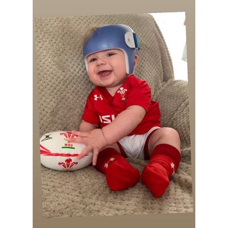 Luca’s Plagiocephaly Journey with the Boston Band