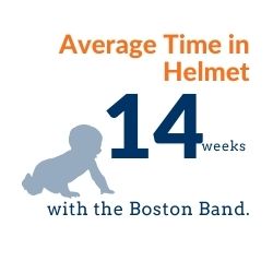 Average Time in the Boston Band for Plagiocephaly